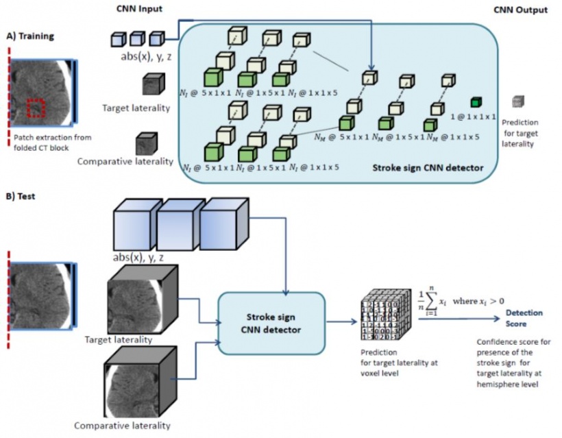 Blocks of data within the brain are extracted and folded along their centerline...