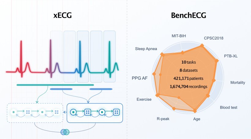 Links: Das neue KI-Modell xECG verarbeitet EKG-Signale als Abfolge kurzer...