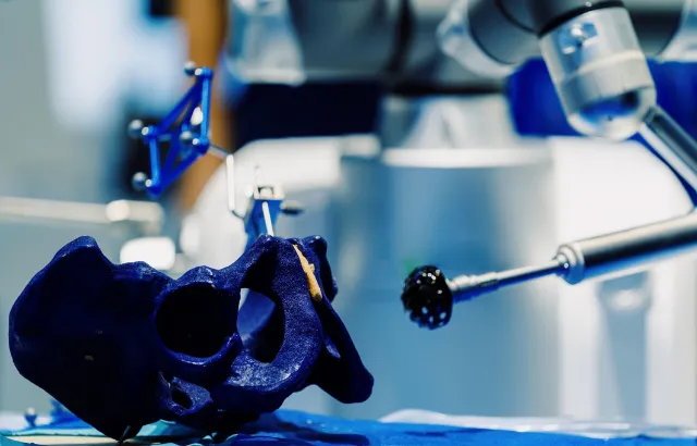 A robotic arm working on a hip prosthesis