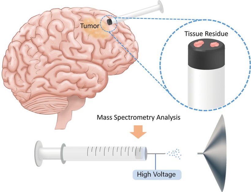 Brain cancer margins can be especially difficult to map. Using mass...