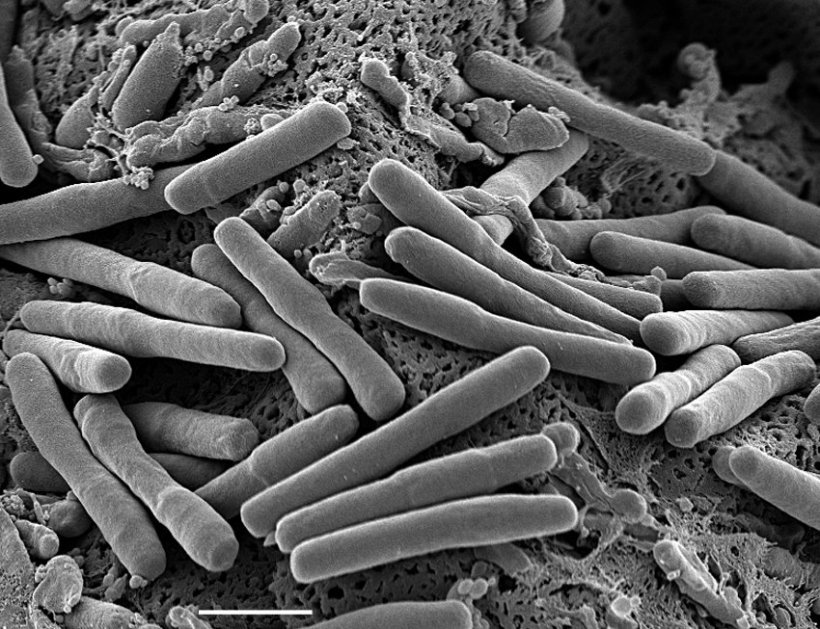 Scanning electron microscopy of Clostridium difficile bacteria