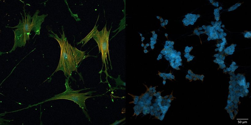 CD44 (grün) aktiviert krebsassoziierte Fibroblasten. Wird das Molekül...