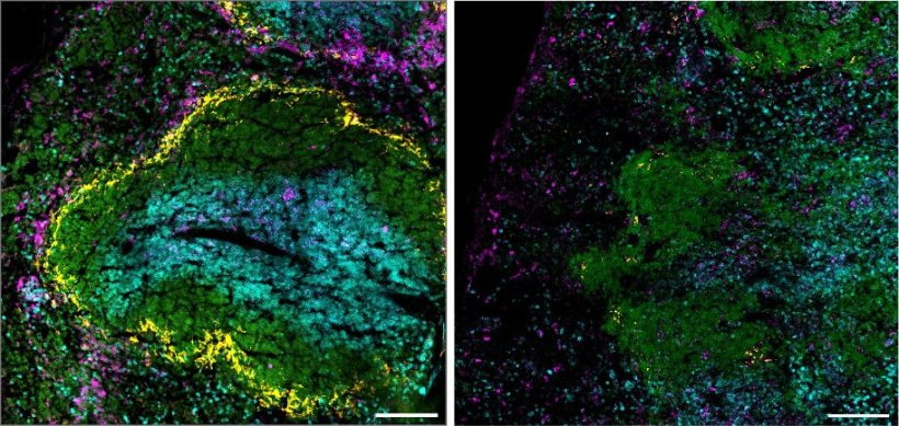 Two images of cell samples from the spleen of a mouse in green, ble and yellow,...