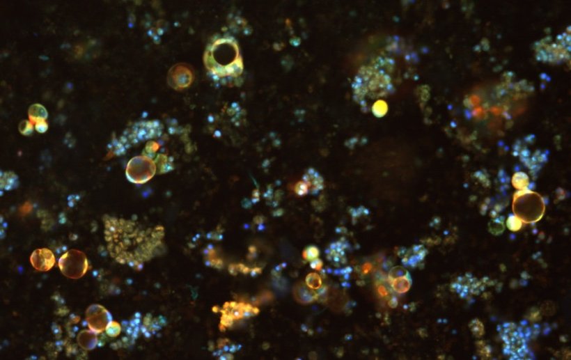 Mini-tumours grown in the laboratory. AI analyses the image, to help...