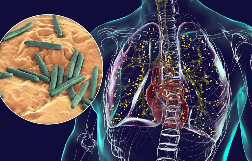 A transparent 3D model of a human upperd body with lungs, heart and spine. A...