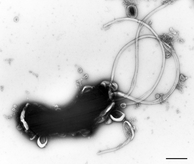 Scanning electron microscopy of a Helicobacter pylori bacterium