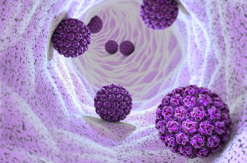 3D illustration of Human papillomavirus (HPV) infection in a body. The viruses...
