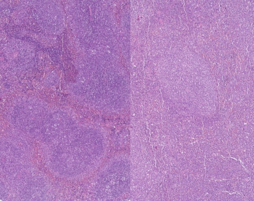 Two different H&E stained slides of murine spleen tissue; the slide on the...