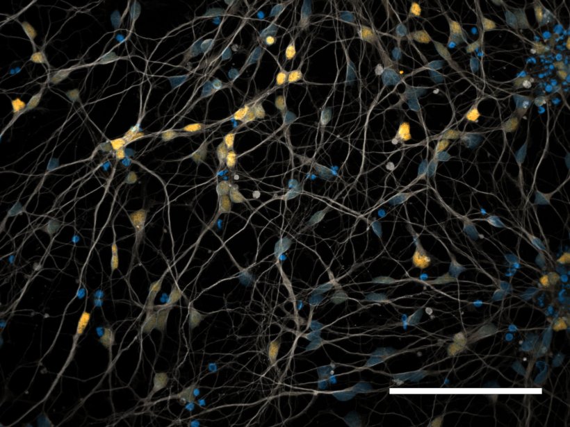 Farblich markierte Neuronen vor einem schwarzen Hintergrund