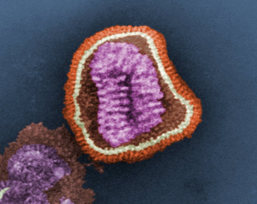 Elektronenmikroskopie-Bild eines Influenzavirus