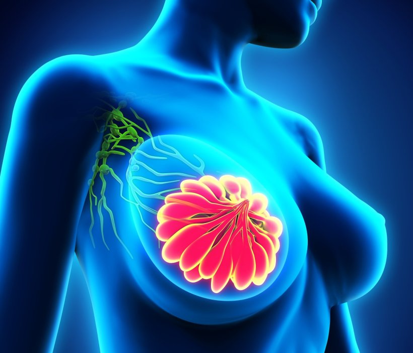 3D illustration of a womans chest area, with the right mammary gland...