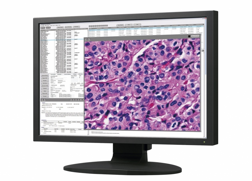 Accurate color for pathology diagnosis
