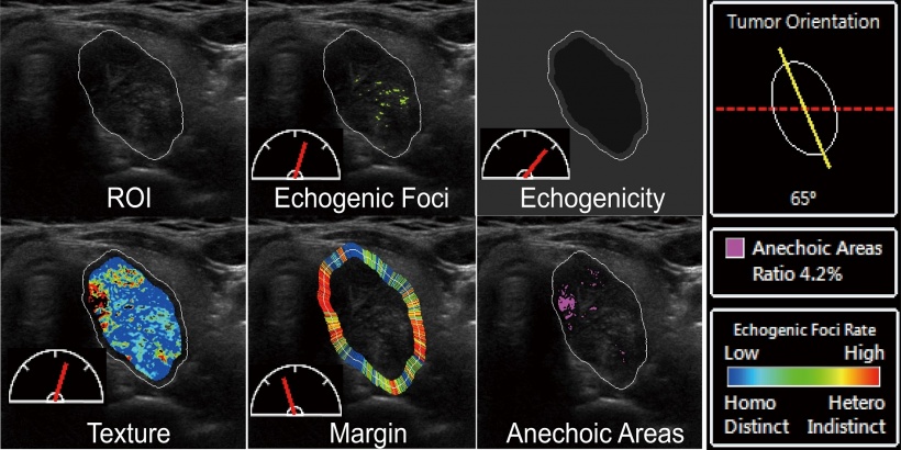 This software uses the power of algorithms to automatically classify thyroid...