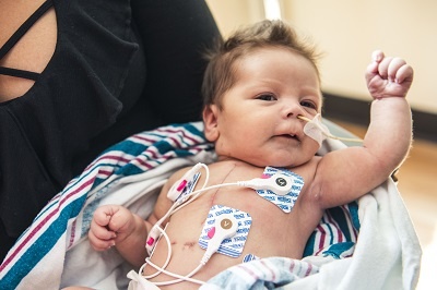 Baby Jasmine was born in late December with hypoplastic left heart syndrome...