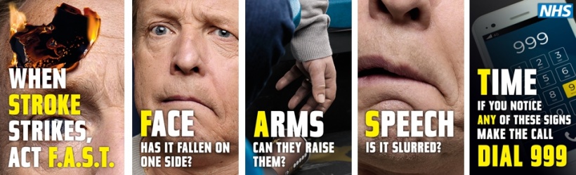 If you suspect a stroke, act F.A.S.T.!