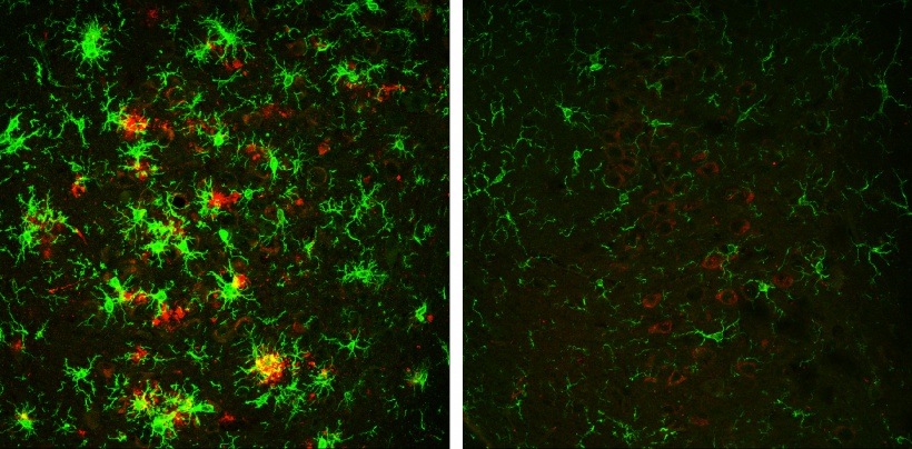 The brain of a 10-month-old mouse with Alzheimer’s disease (left) is full of...