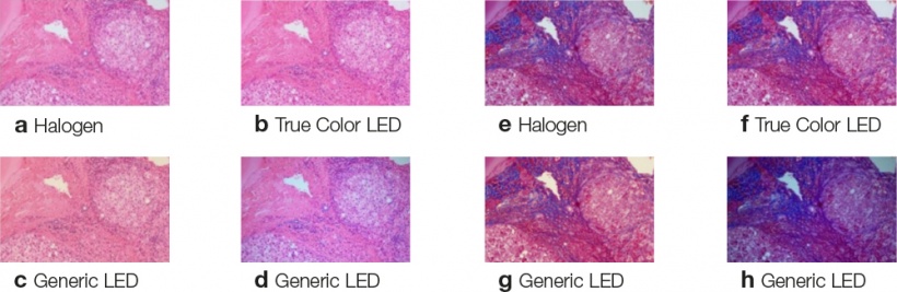 Both in H&E-stained (a-d) and in Azan-stained tissue sections (e-h) True Color...