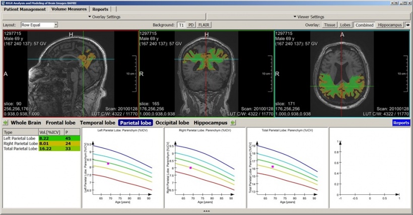 Prototype work station allowing to automatically determine regional brain...