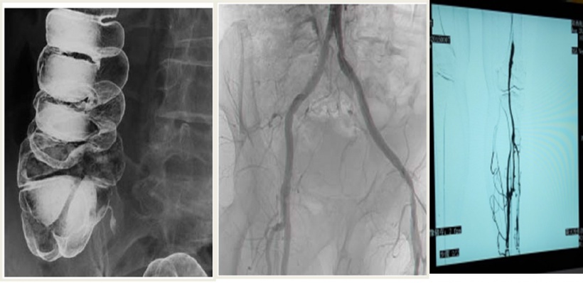 A unique imaging platform for dynamic X-ray applications