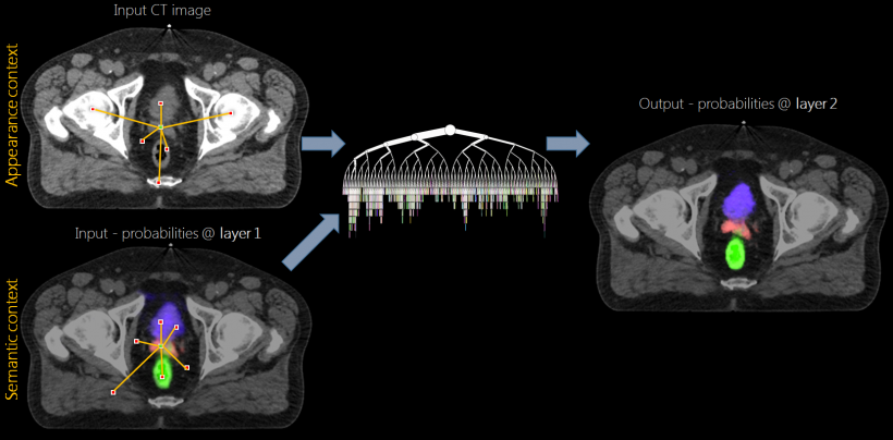 The InnerEye researchers prefer to use deep decision forests for their semantic...