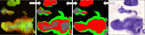 Using image analysis algorithms, multi-modal tissue images (left) can be...