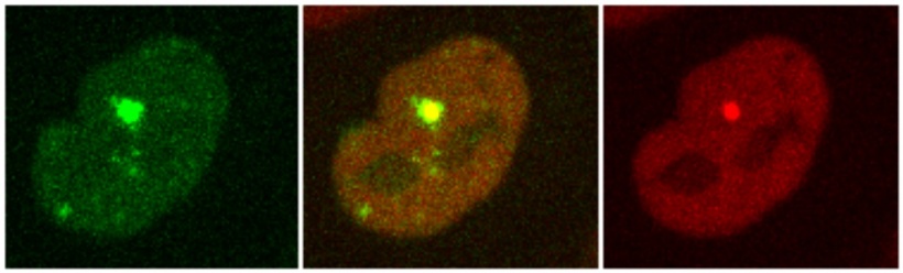 Recruitment of two proteins to the sites of DNA damage generated by laser...