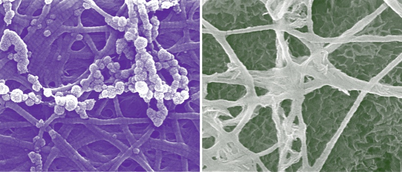 Calcium phosphate mineralization occurs in both extra- and intrafibrillar...