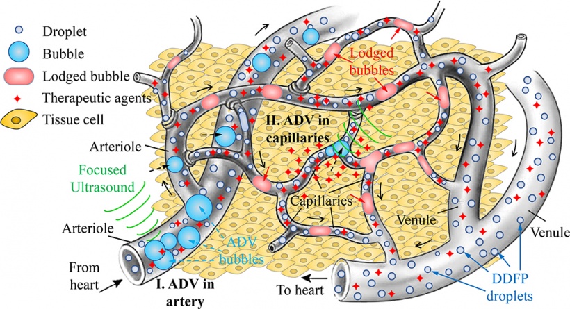 Gas embolotherapy scenario