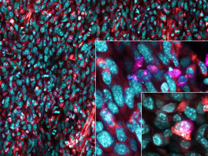 View of cells within a mouse tumor with increasing magnification. TAMs show red...