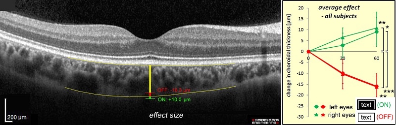 Abbildung 2. Links: OCT Bild der Netzhaut und der Aderhaut im lebenden Auge....
