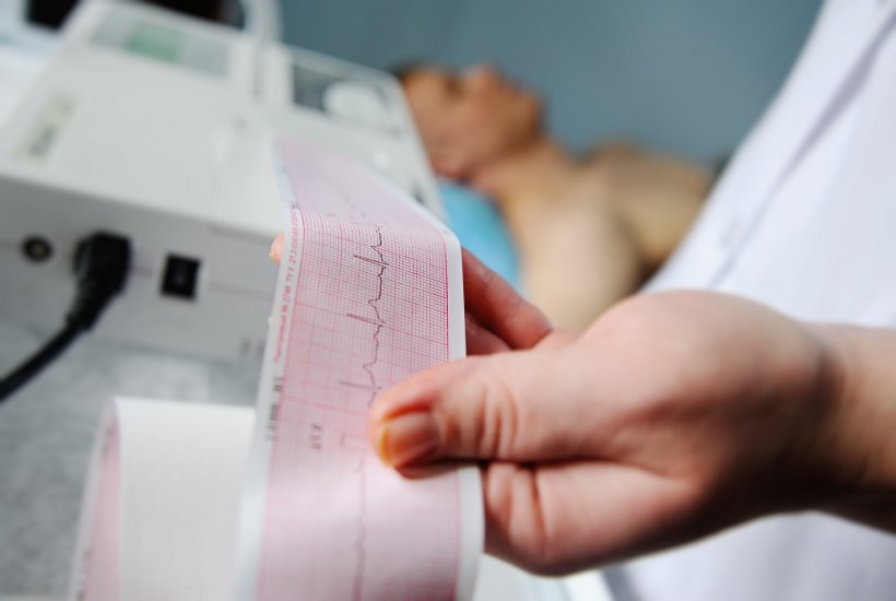 doctor holding a ecg reading on a paper strip
