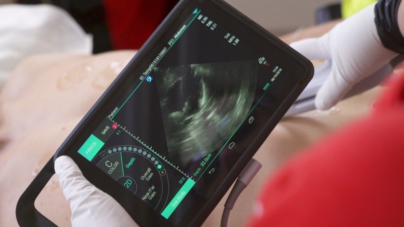 The iViz portable ultrasound system