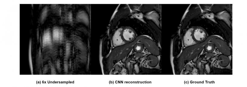 Image reconstruction is another field in which AI and ML can be of great use...