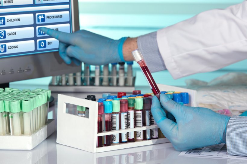 hands of a lab technician holding blood tube sample and and touching screen...