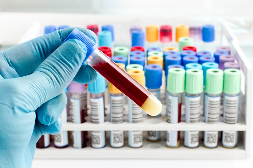 hand of a lab technician holding blood tube test and background a rack of color...