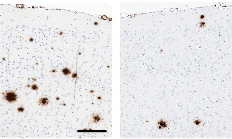 Compared to a control (left), a soluble version of TLR5 (right) reduces the...