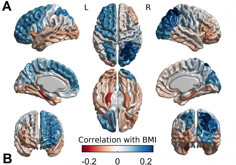 How cortical thickness associates with BMI. Body mass index relates positively...