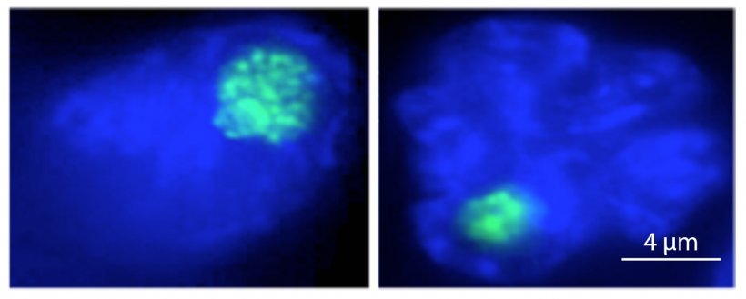 Der Nukleolus (in grün) von Makrophagenzellen schrumpft bei einer bakteriellen...