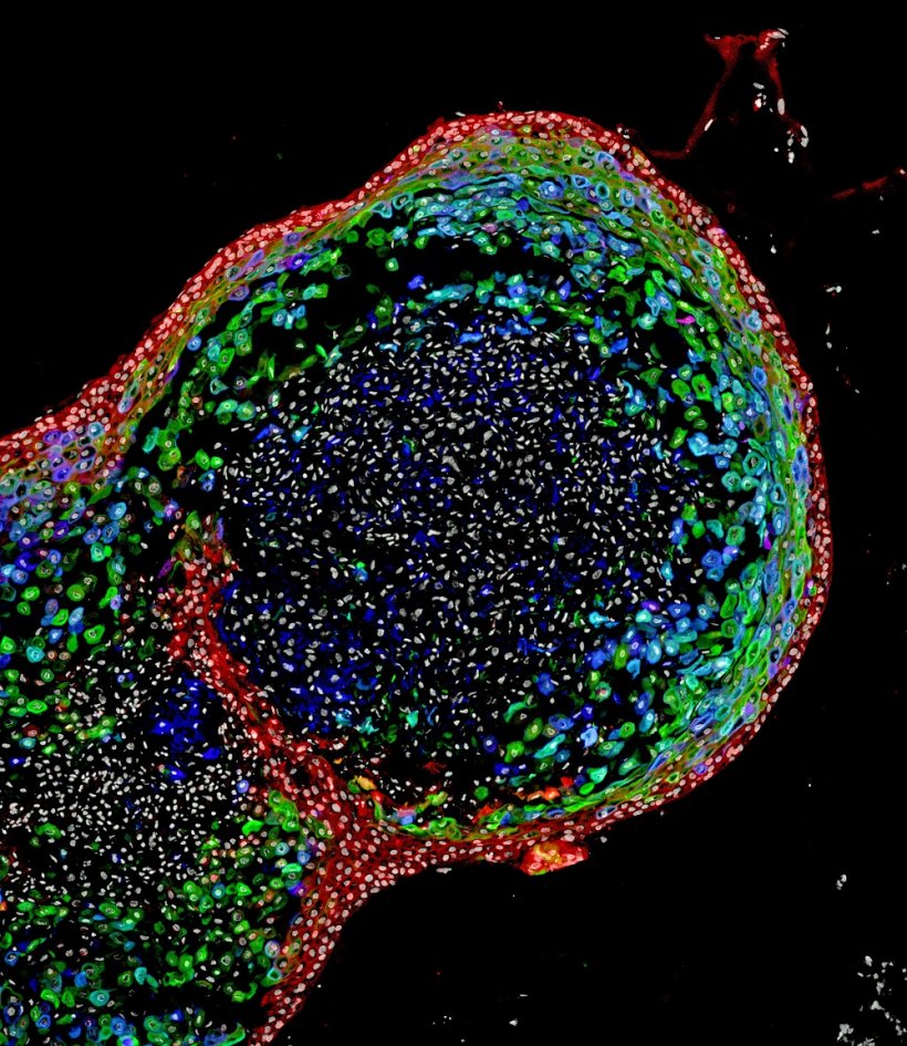 This confocal microscopic image shows a two-month-old human esophageal organoid...