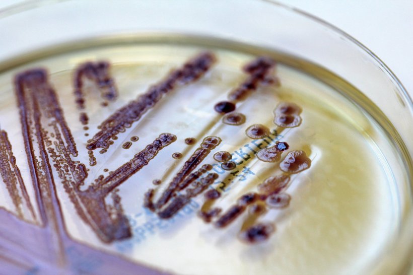 Long test procedures such as cultivation on agar may soon be a thing of the...