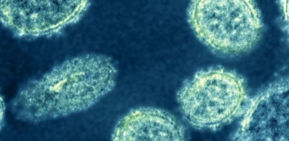 Influenza virus molecules set immune response into overdrive.