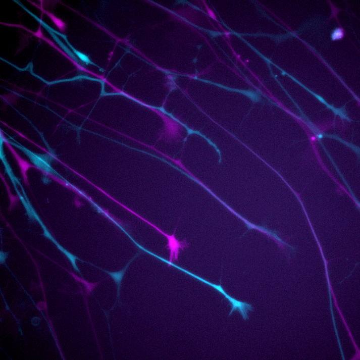 Neurite outgrowth assay of neurons expressing GFP. The first and last time...