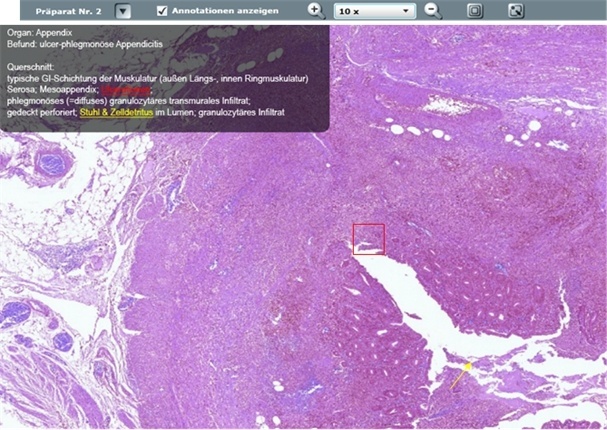 Digital pathology is already an important part of teaching at the Institute for...