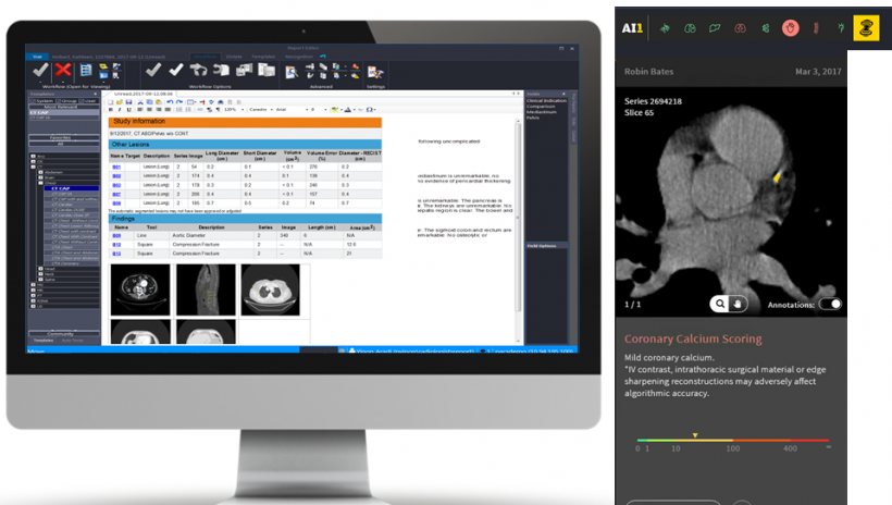 Screenshots of the Carestream AI Orchestrator tool