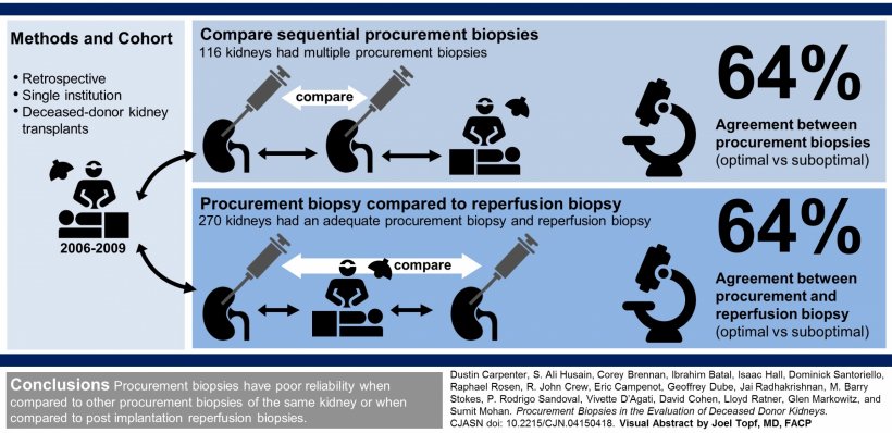 Are procurement biopsies reliable for judging deceased donor kidneys?