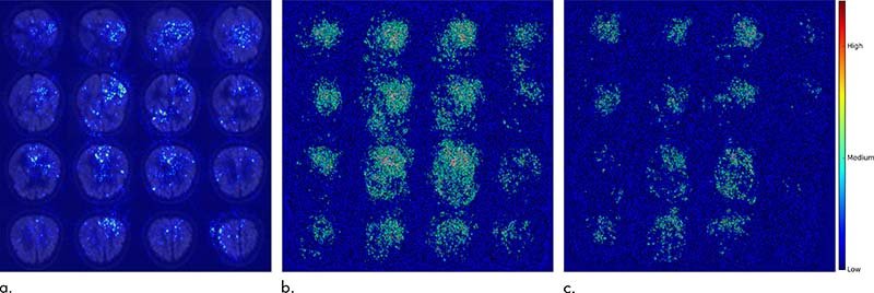 Saliency map of deep learning model Inception V3 on the classification of...