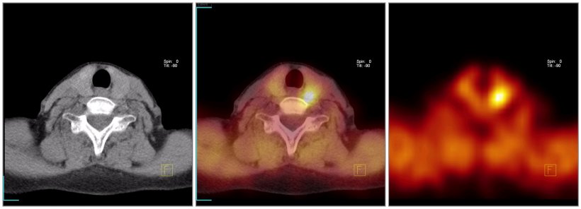 The multi-slice CT showing anatomical details of diagnostic (picture on the...