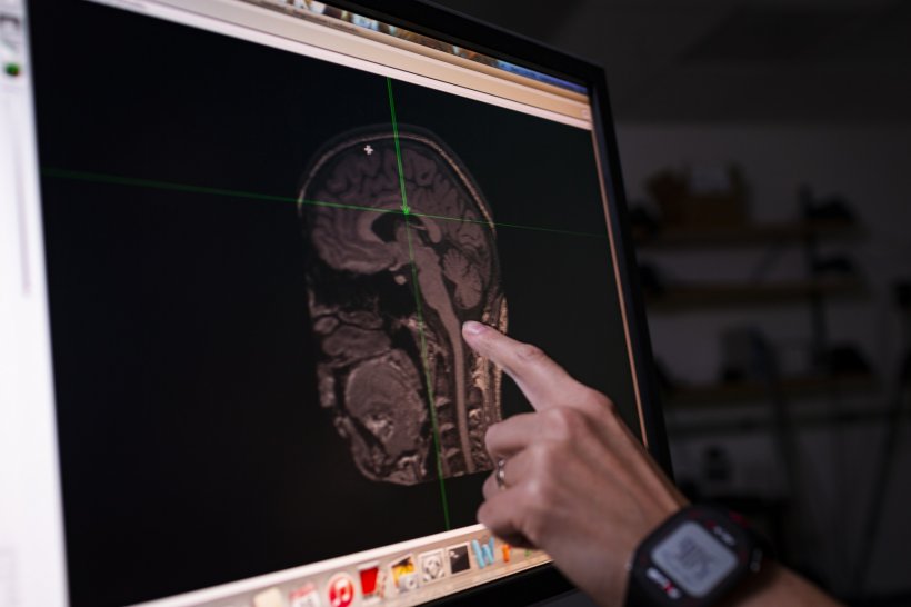 hand pointing at a screen with a mri image of a human head on it