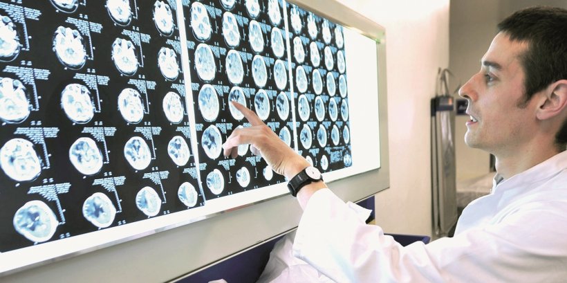 man in a white medical coat pointing at mri images of human head