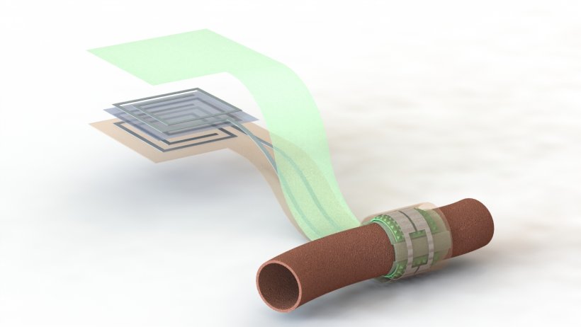 Artist’s depiction of the biodegradable pressure sensor wrapped around a...